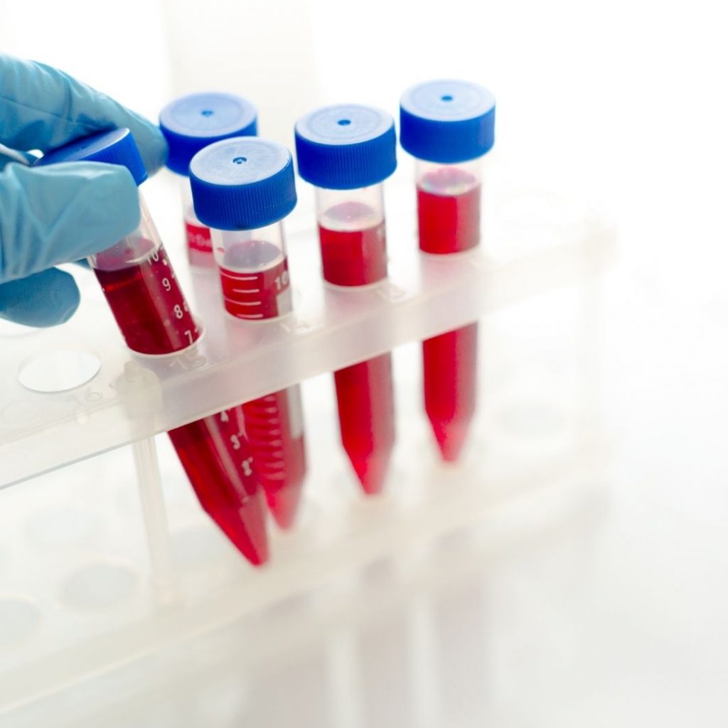 Endokrinologija - testovi krvi